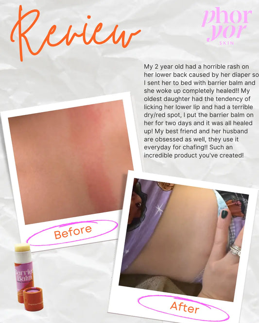 Barrier Balm Deluxe Phoryor Skin