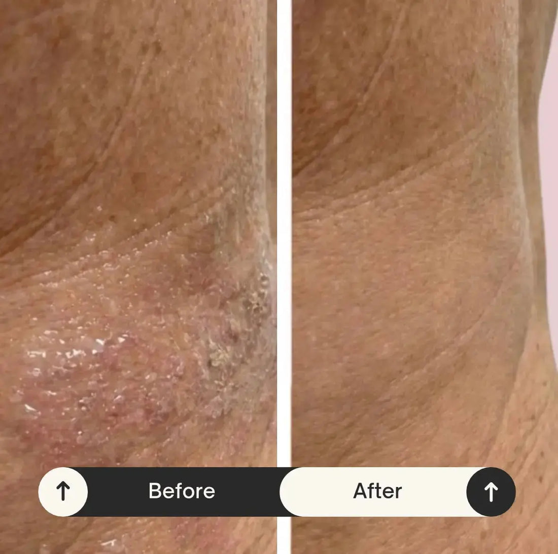 How-to-Repair-a-Damaged-Skin-Barrier-Key-Symptoms-to-Recognize Phoryor Skin