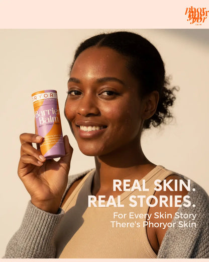 Phoryor Skin Barrier Balm for dry patches and over-exfoliated skin