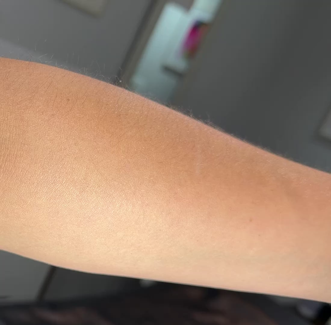 Phoryor All Over Oil on body skin