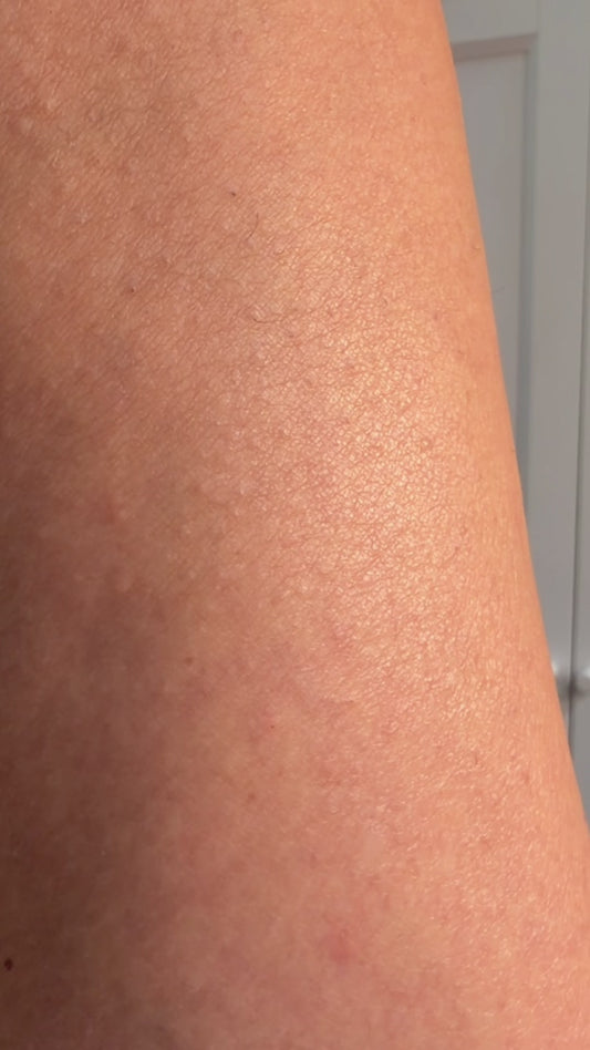 Phoryor Fix It Spray, All Over Oil and Barrier Balm together